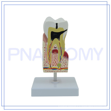 ПНТ-0542 модель человеческих зубов уход 